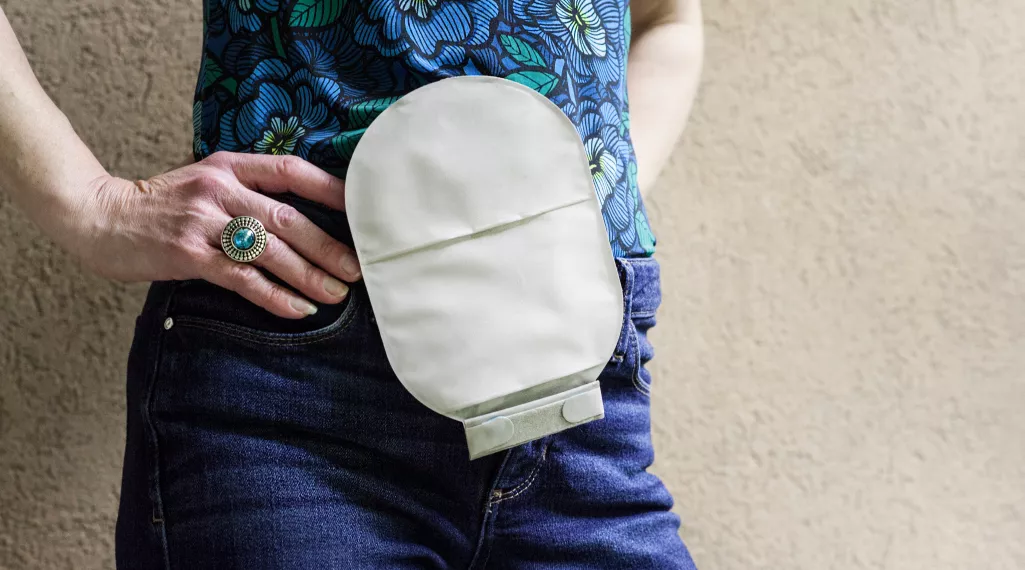 woman in blue with ostomy