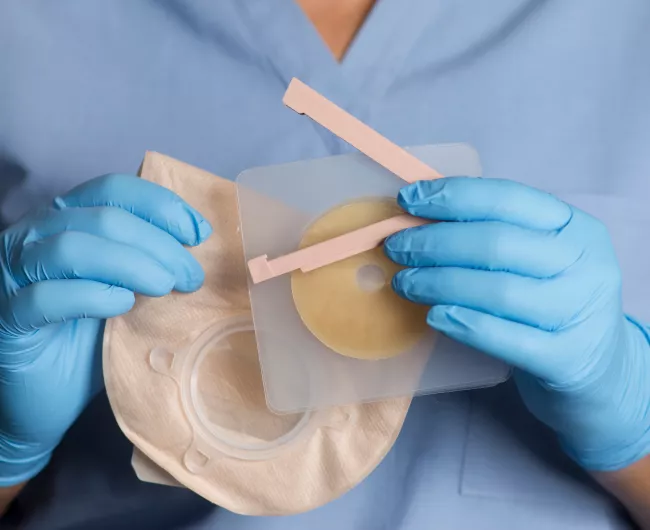 ostomy supply