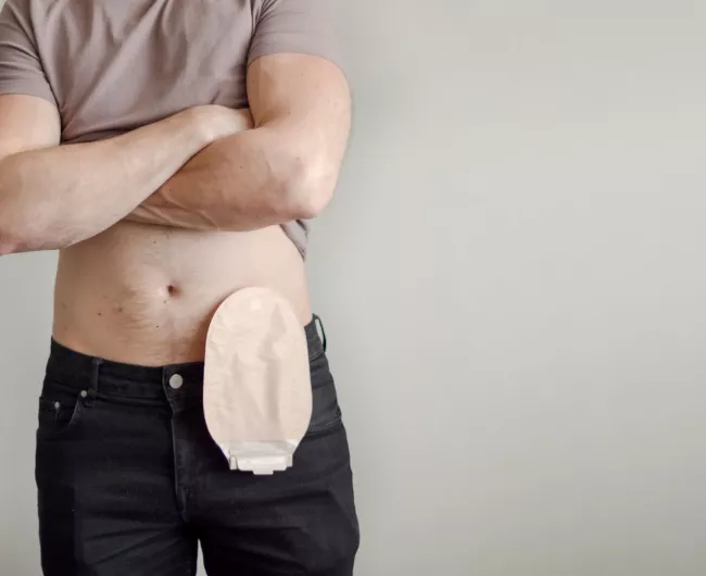 man with an ostomy